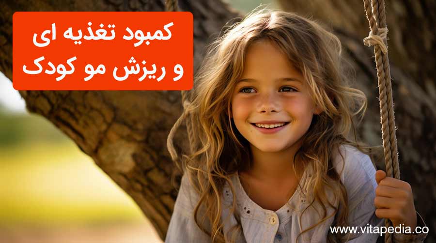 کمبود تغذیه ای و ریزش مو کودک